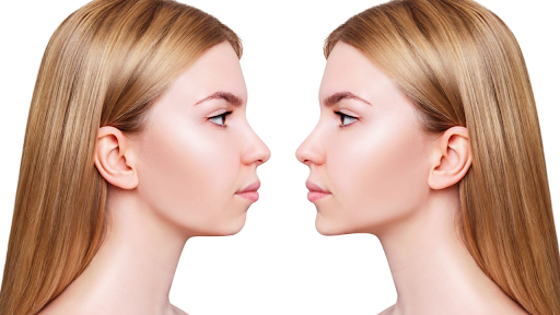 Double Jaw Surgery: What I Wish I Knew Before Going Under the Knife