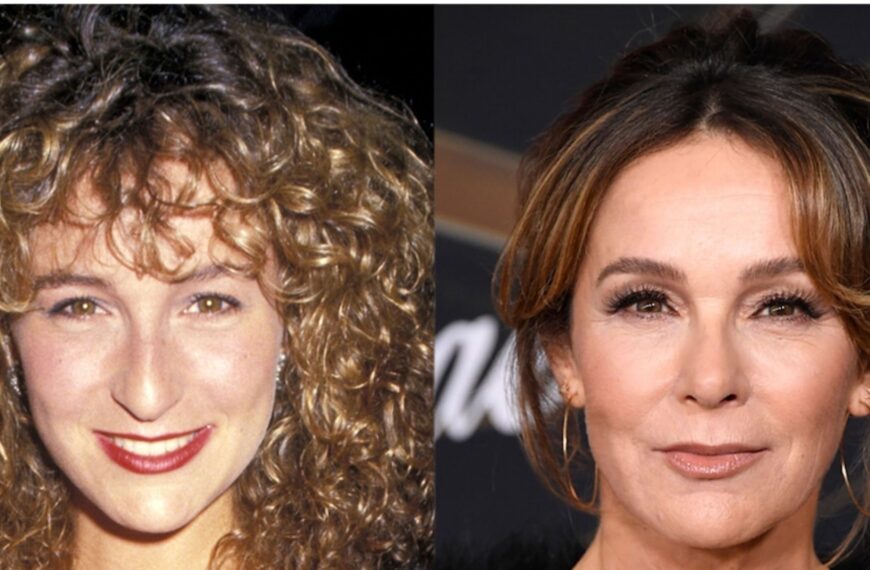 jennifer grey before and after rhinoplasty